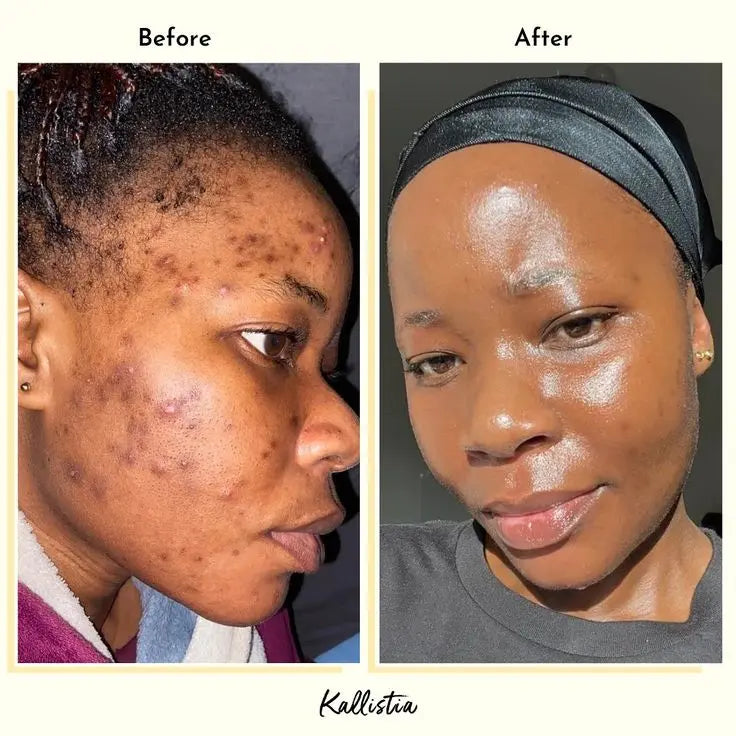 Crème 345 _anti tâche _anti imperfections